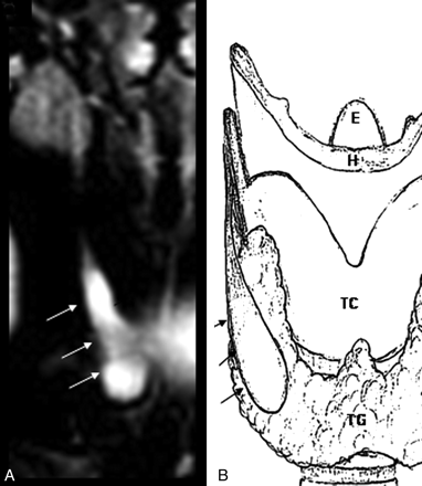 Fig 4.