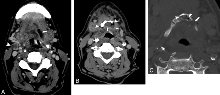 Fig 2.