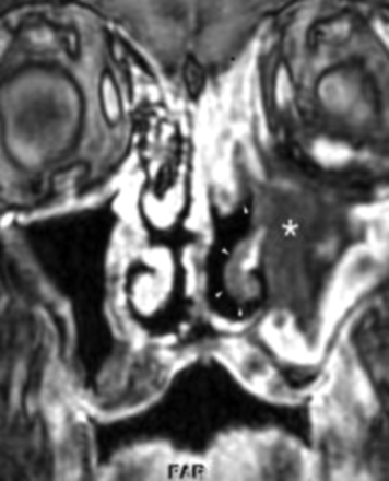 Fig 1.