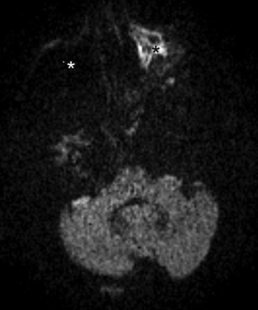Fig 3.