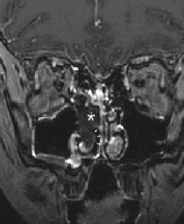 Fig 6.