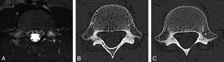 Fig 3.