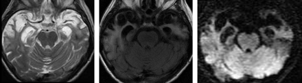 Fig 7.