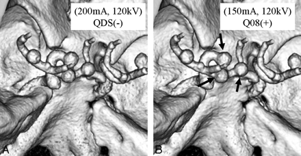 Fig 4.