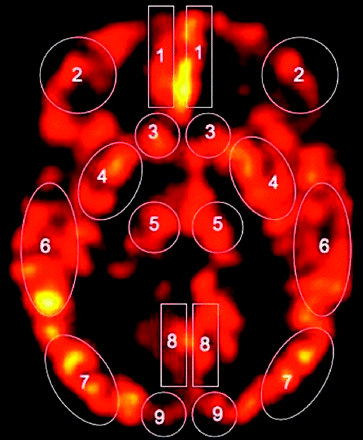 Fig 1.