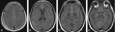 Fig 2.
