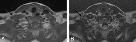 Fig 1.