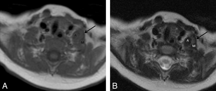Fig 2.