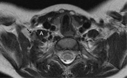 Fig 3.
