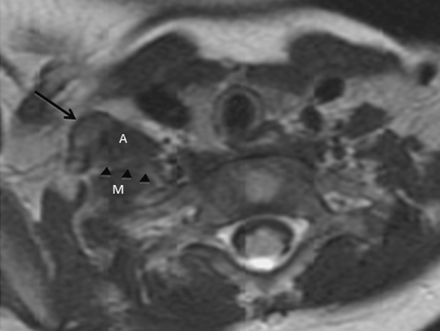 Fig 4.
