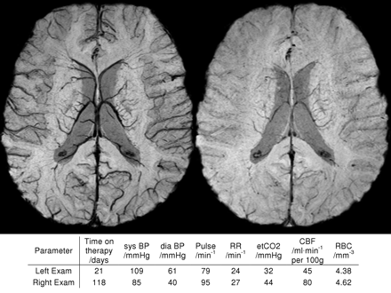 Fig 2.