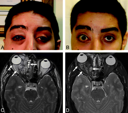 Fig 1.