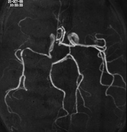 Fig 2.