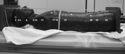 Fig 1.