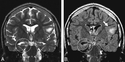 Fig 1.
