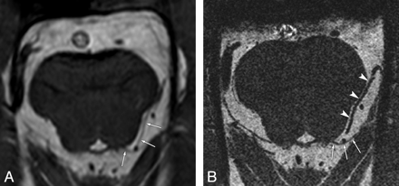 Fig 3.