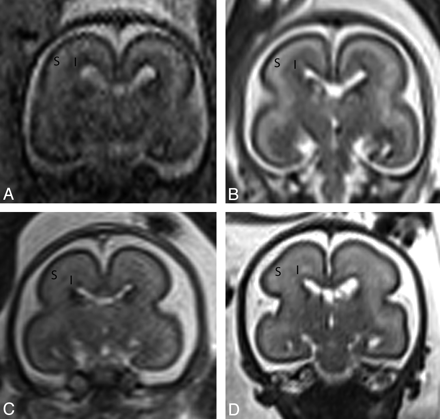 Fig 8.