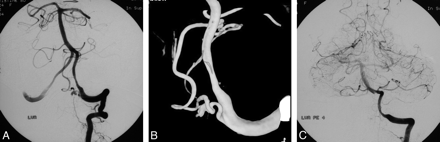 Fig 2.