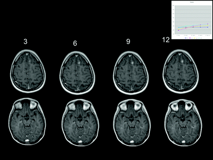 Fig 4.