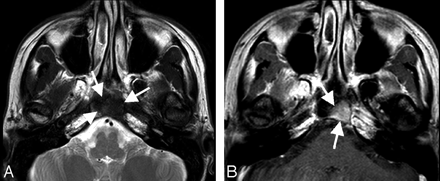 Fig 2.