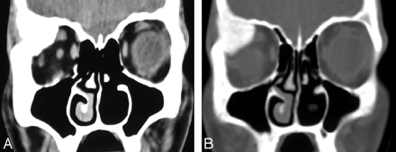 Fig 4.