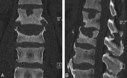 Fig 5.
