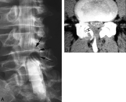 Fig 6.