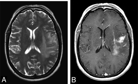 Fig 2.