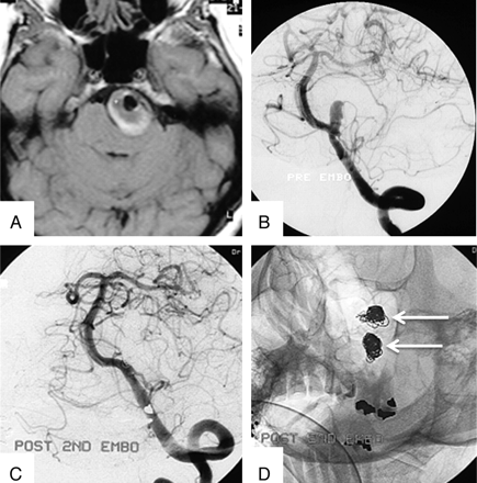 Fig 5.