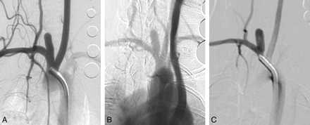 Fig 2.