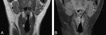 Fig 1.
