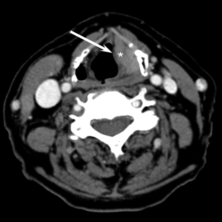 Fig 2.