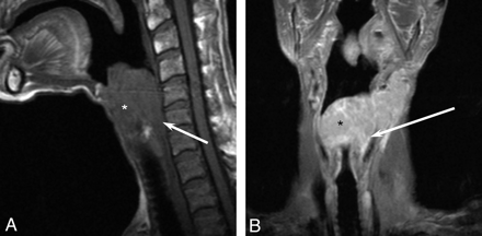 Fig 4.