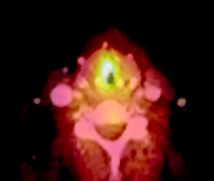 Fig 5.