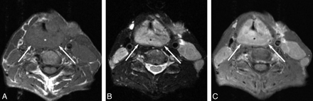 Fig 6.
