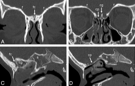 Fig 5.