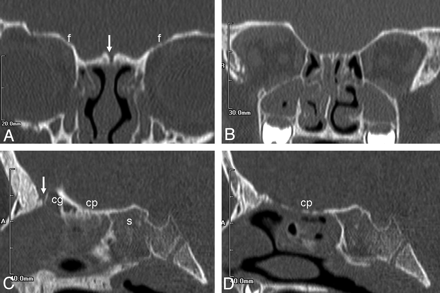 Fig 8.