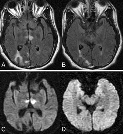 Fig 4.