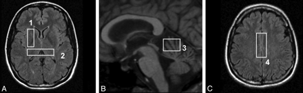 Fig 1.
