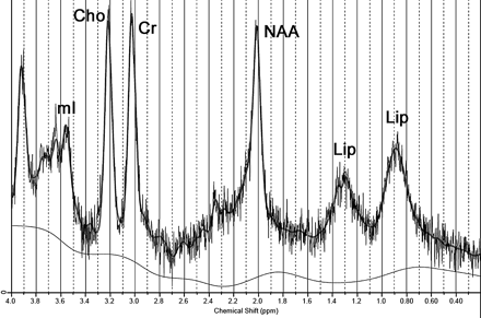 Fig 4.