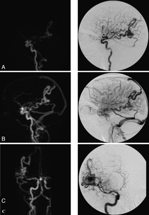Fig 3.