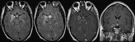 Fig 3.