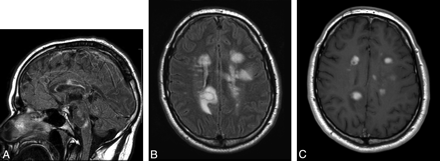 Fig 3.