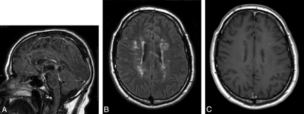Fig 4.