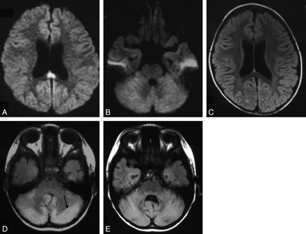 Fig 2.