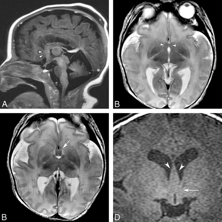 Fig 4.