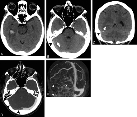 Fig 3.