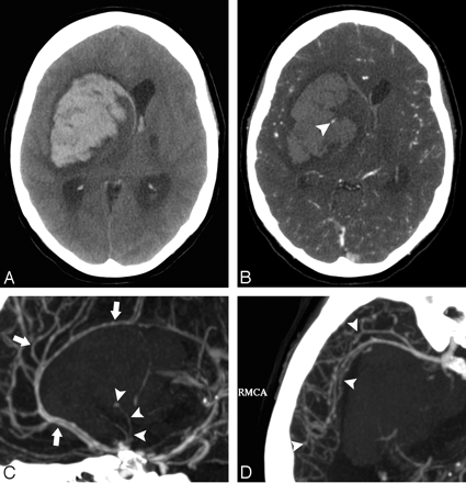 Fig 5.