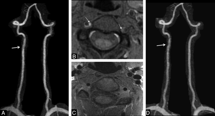 Fig 2.