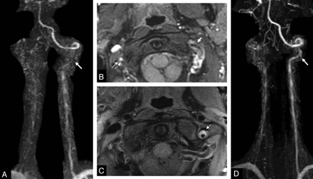 Fig 3.